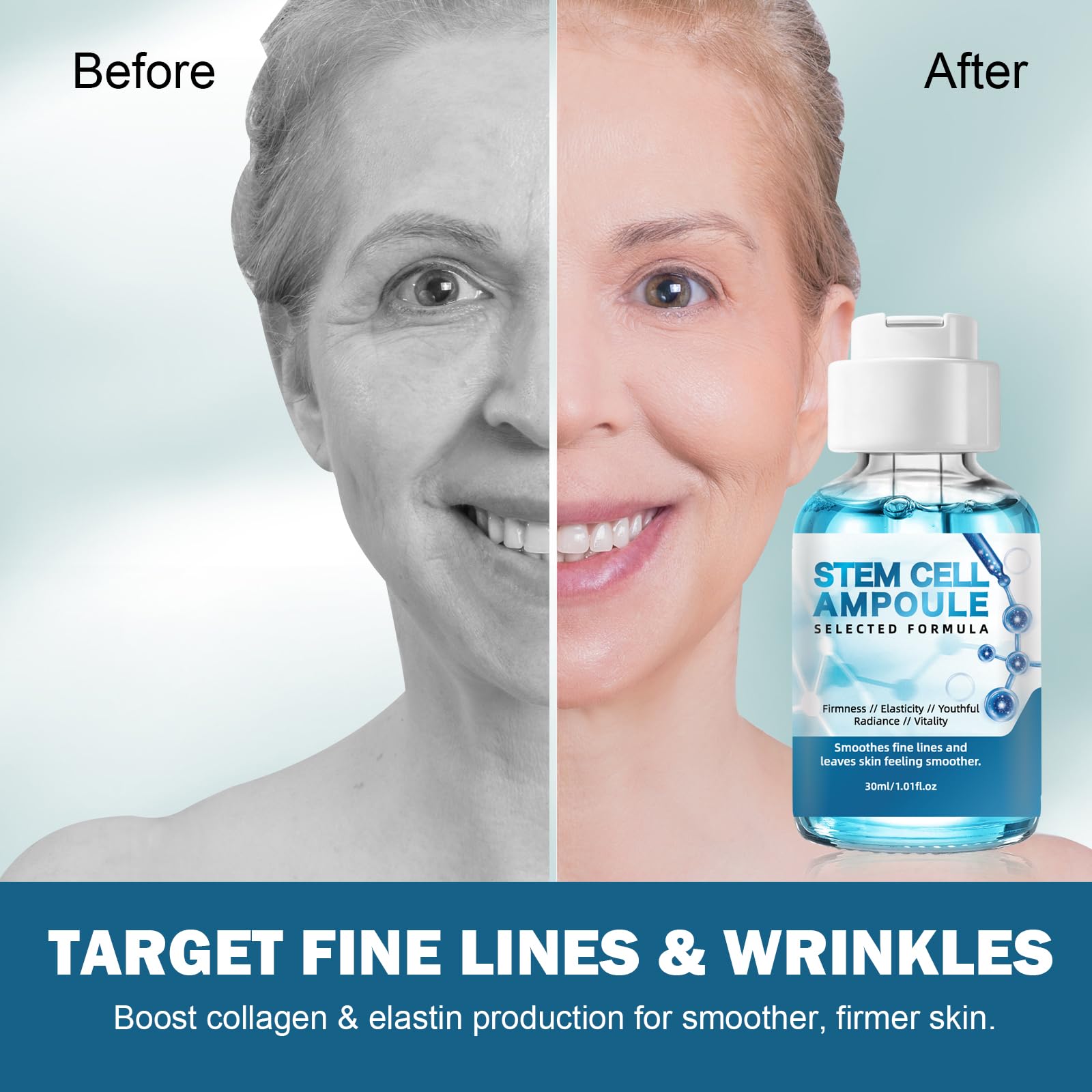 Racgrul stem cell serum applied with derma pen for microneedling routine