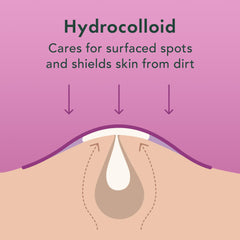 Rael patches apply with strong adhesion, staying put on blemishes.