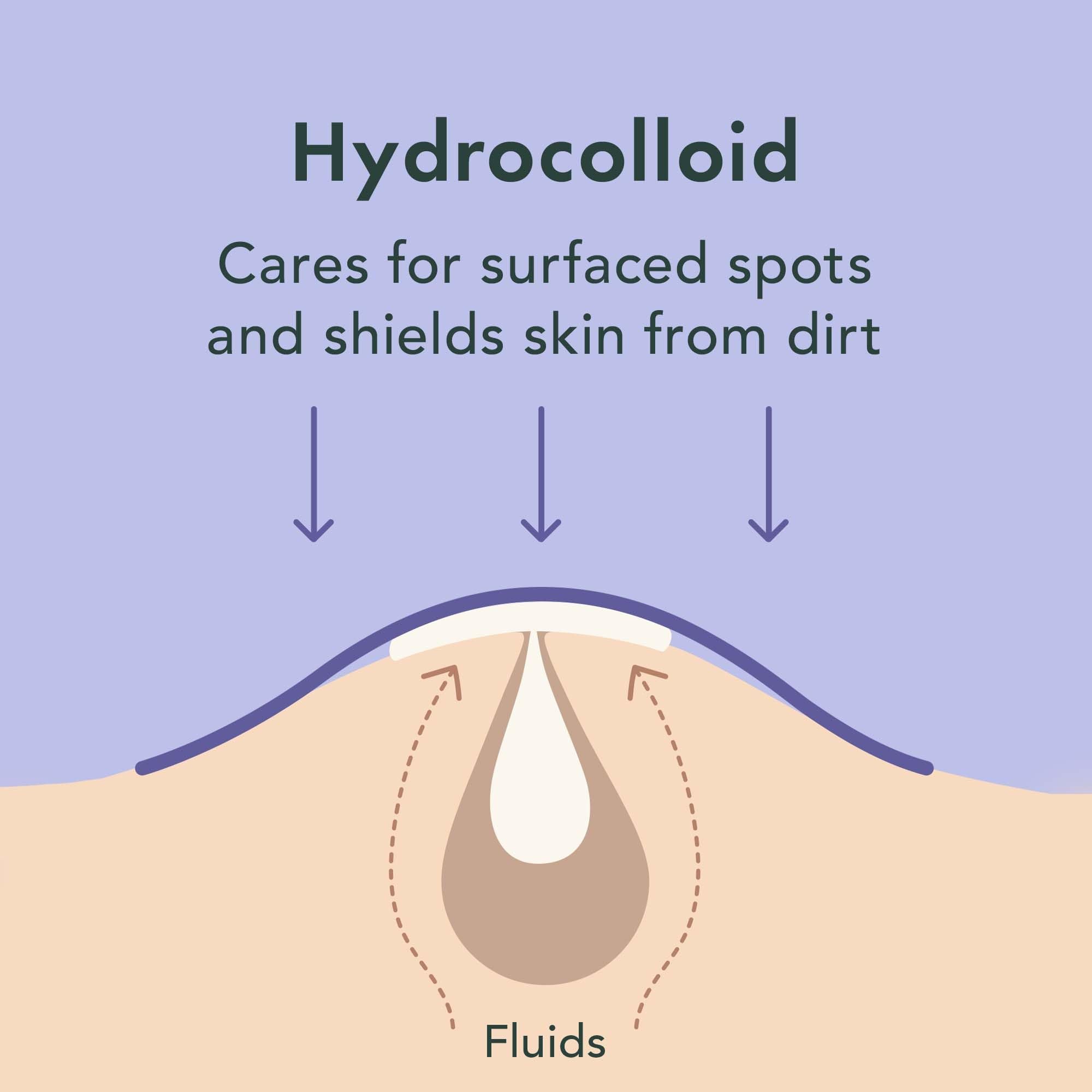 Rael pimple patches edges-stay-on illustrate secure adhesion through day and night.