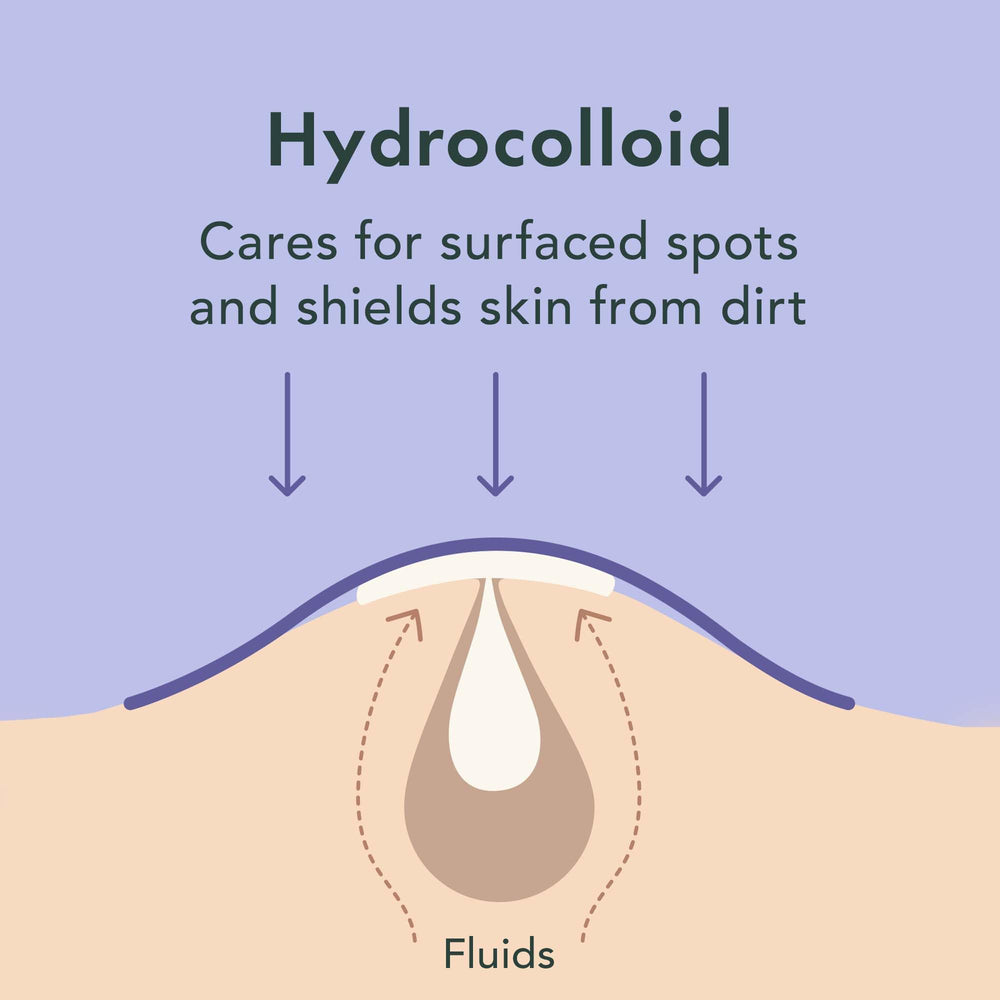 Rael pimple patches edges-stay-on illustrate secure adhesion through day and night.