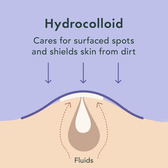 Rael pimple patches edges-stay-on illustrate secure adhesion through day and night.