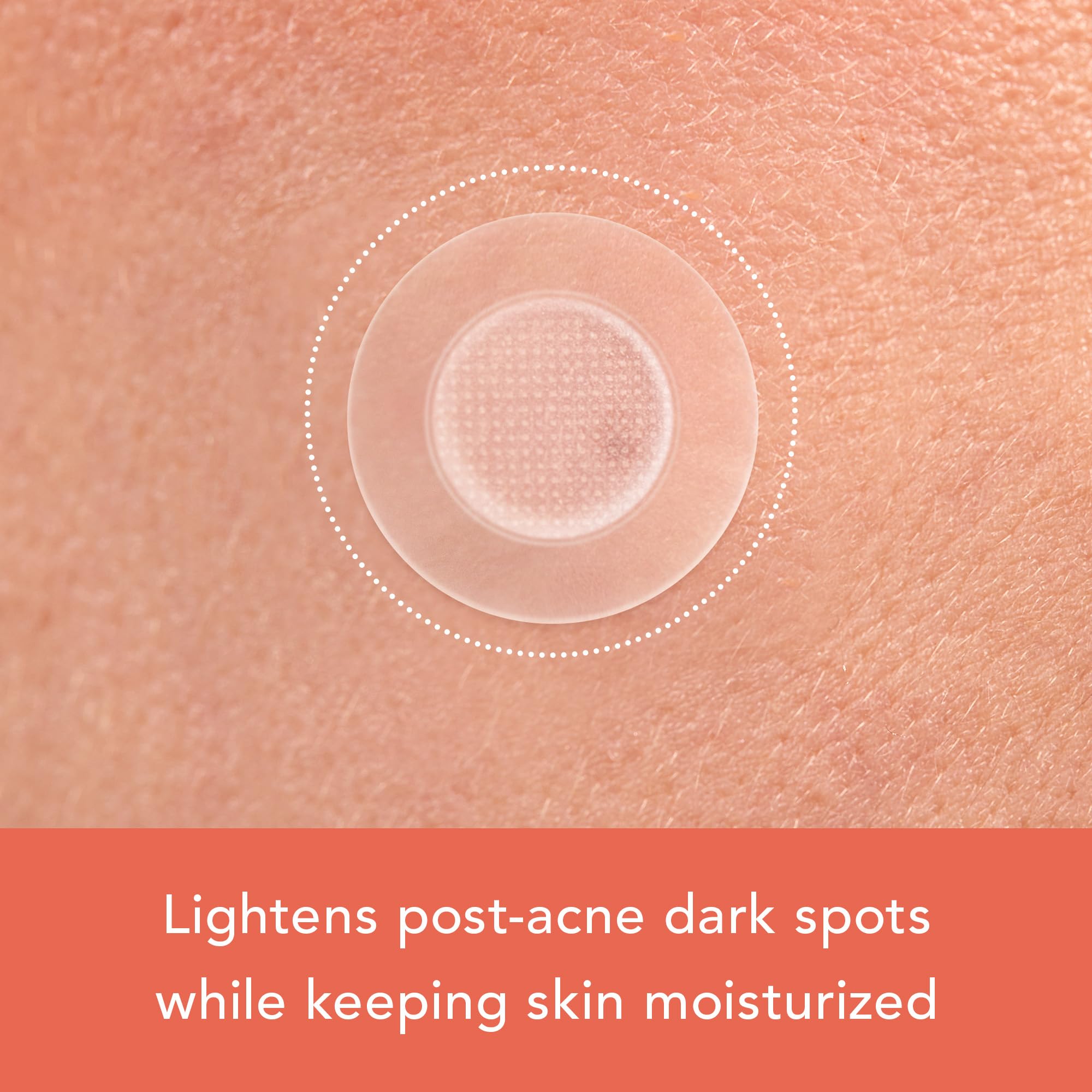 Rael pimple patches ingredients table showing vitamin C, niacinamide, and glutathione.