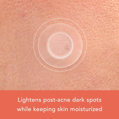 Rael pimple patches ingredients table showing vitamin C, niacinamide, and glutathione.