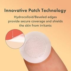 Rael pimple patches texture close-up highlighting flexible, invisible wear.
