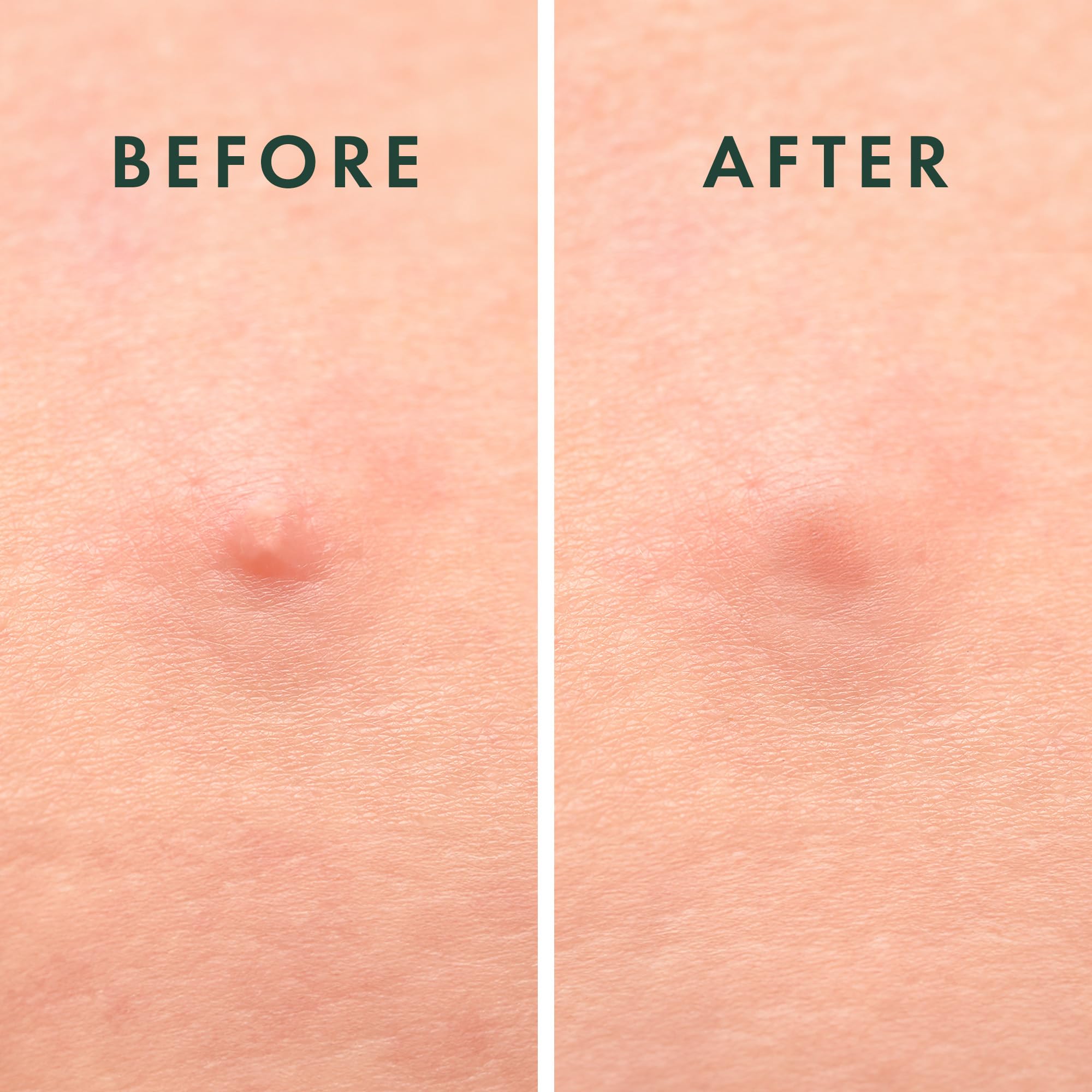 Rael succinic acid skin-support highlight for balanced moisture