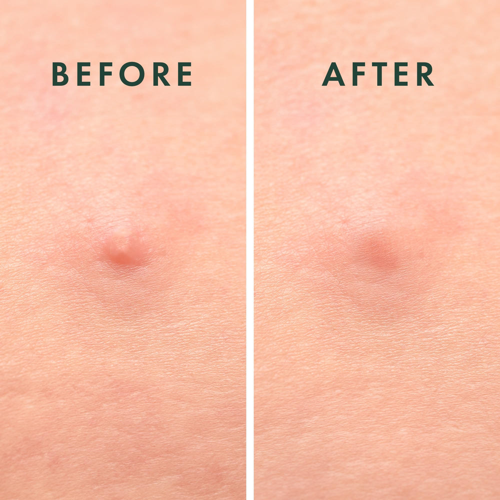 Rael succinic acid skin-support highlight for balanced moisture