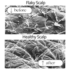 RAUSCH Coltsfoot shampoo ingredients view highlights natural Coltsfoot extract