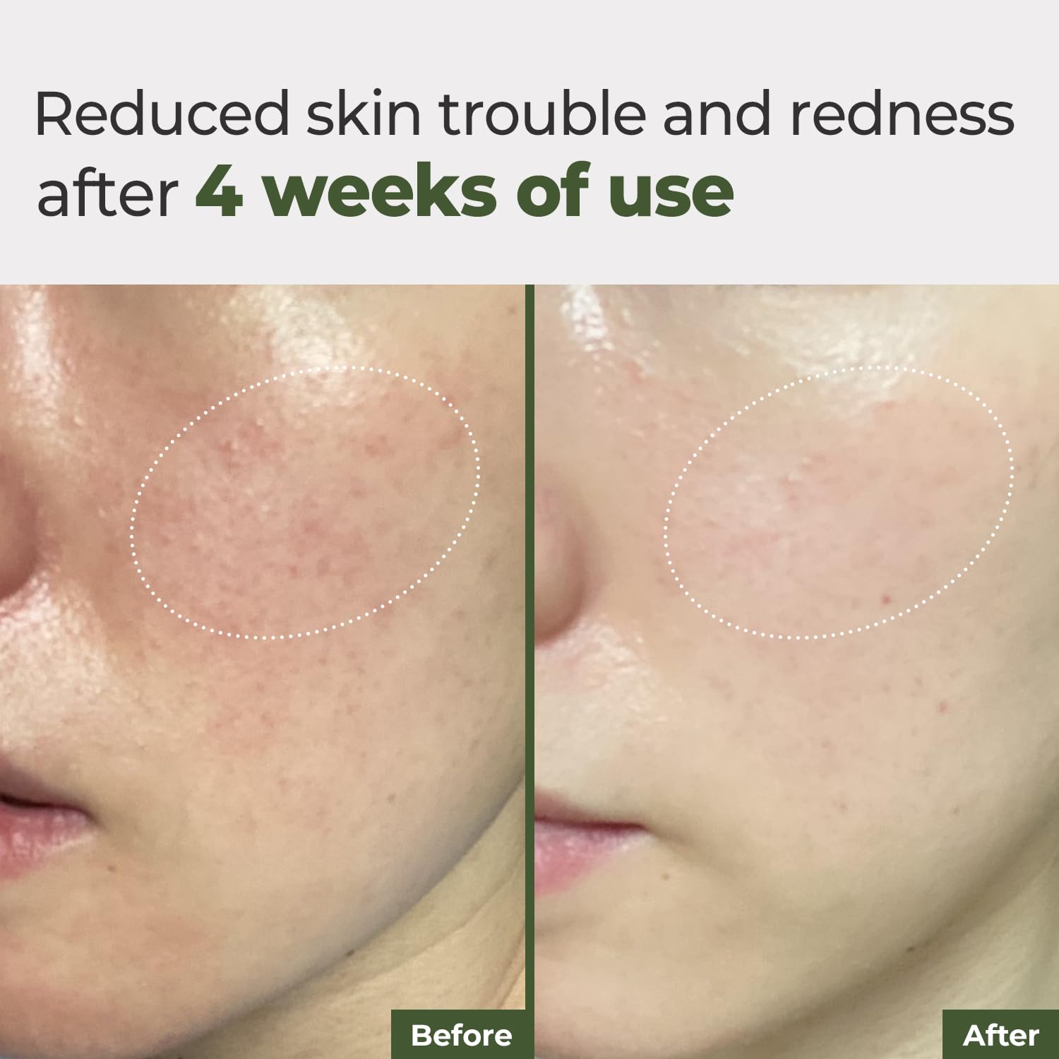 Rbfy Daily Ampoule Pad being applied to the face during a morning routine.
