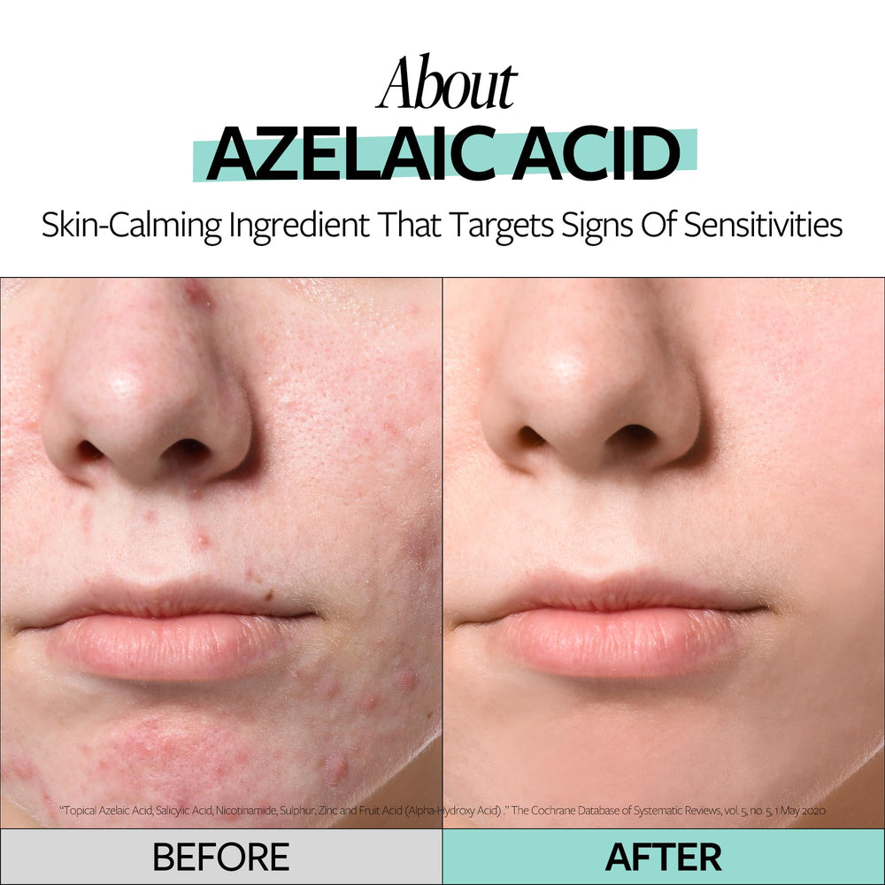 RE:CIPE Azelaic Acid 10 application demonstrates easy day-night layering