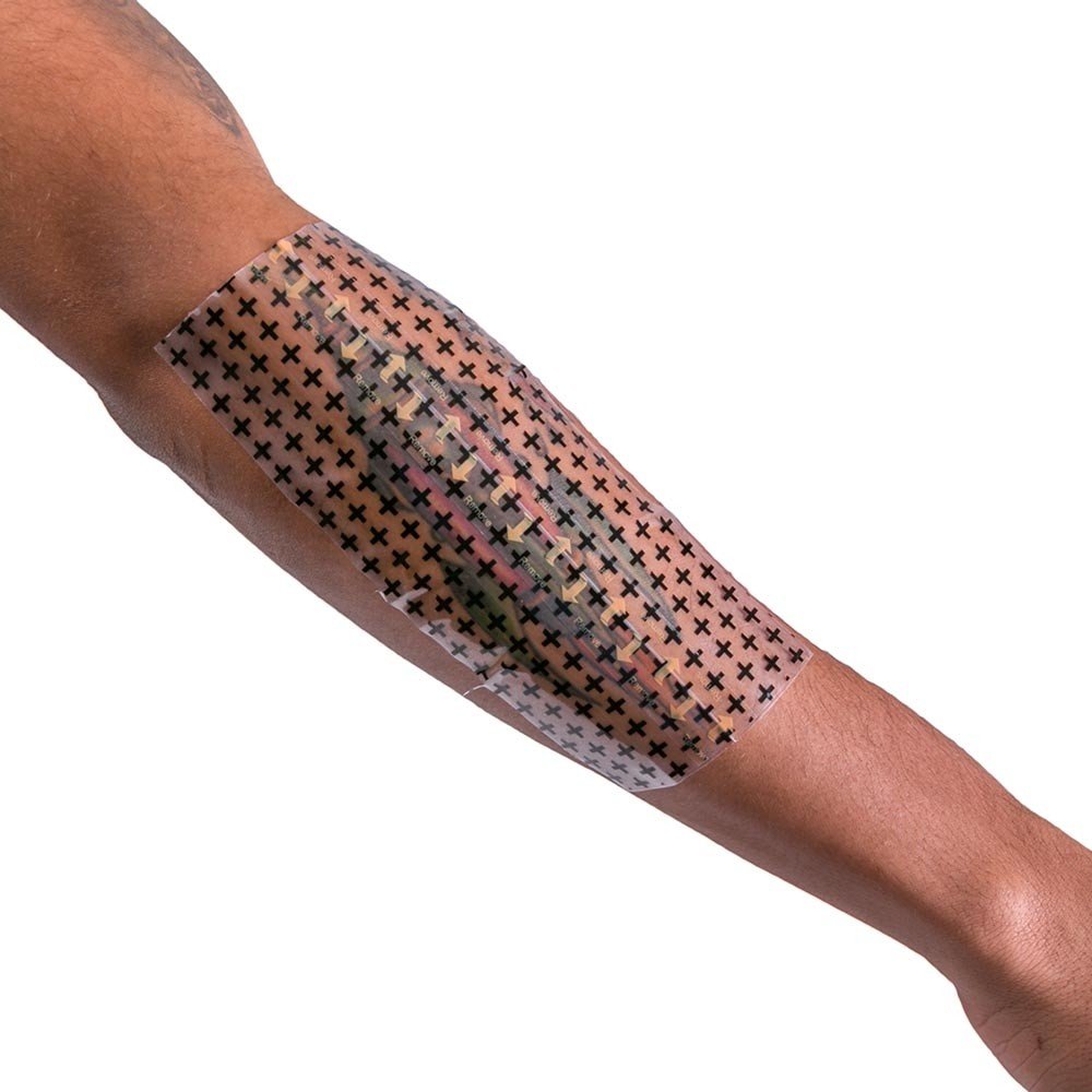 Recovery Derm Shield breathable design supports comfortable healing under daily activities.