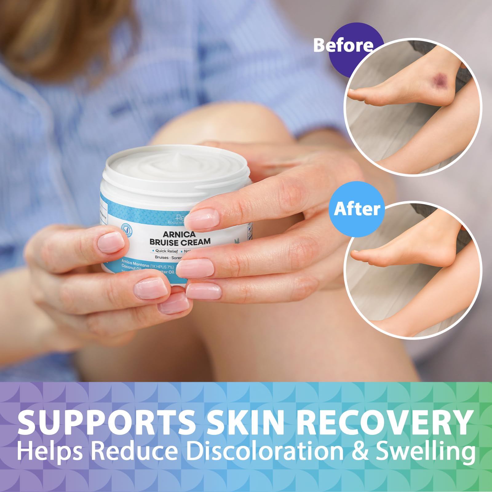 Recuren Plus Arnica Cream on face for delicate skin comfort.