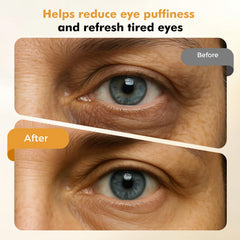REDLOOK Depuffing Wand eye massager for smoother eye area.