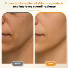 REDLOOK Depuffing Wand face roller for targeted contour work.