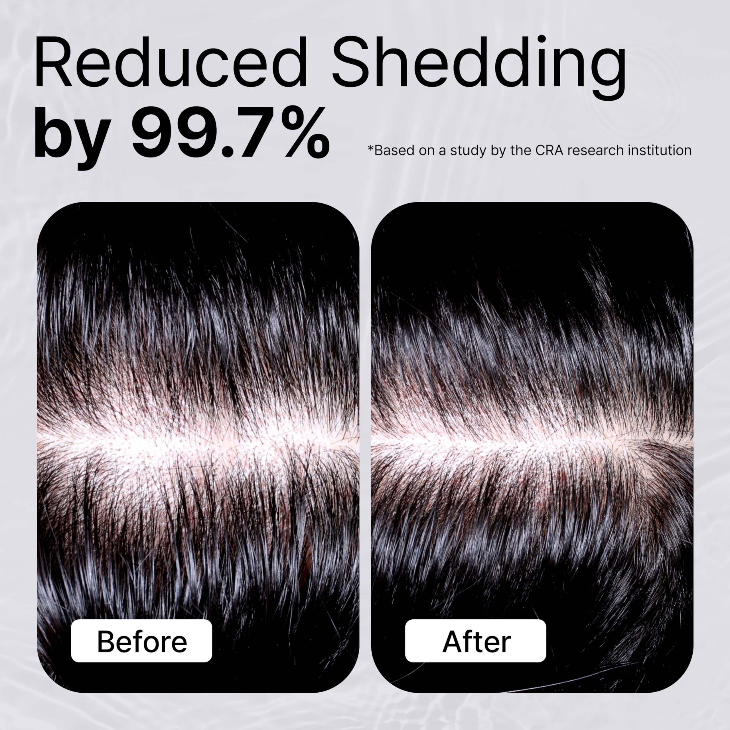 Refilled Booster Plus Moisture built-in massager demonstrates scalp stimulation during use.