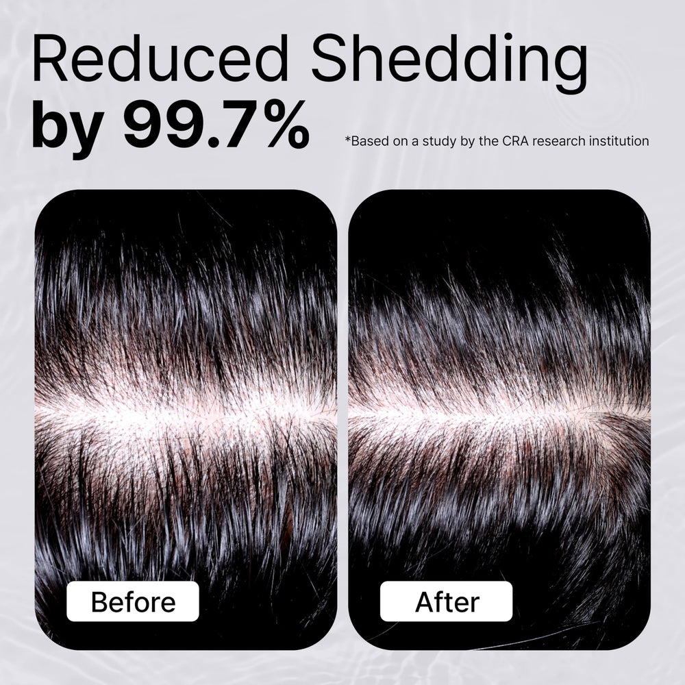 Refilled Booster Plus Moisture built-in massager demonstrates scalp stimulation during use.