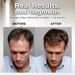 Hands applying 2-in-1 shampoo to wet hair.