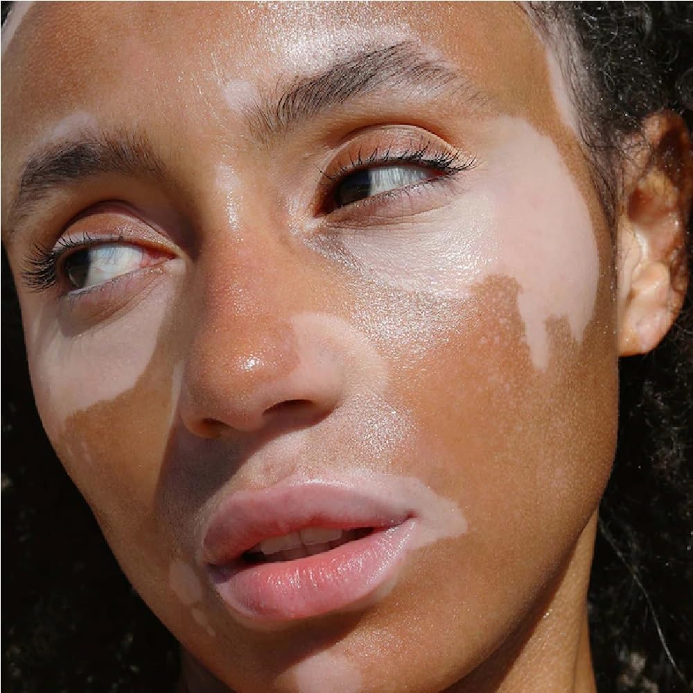 R.E.F.Y Acne Patch heart-shape design; highlights easy blemish coverage and quick application.