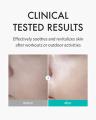 REJURAN skin protection mask absorption gives quick hydration on irritated skin