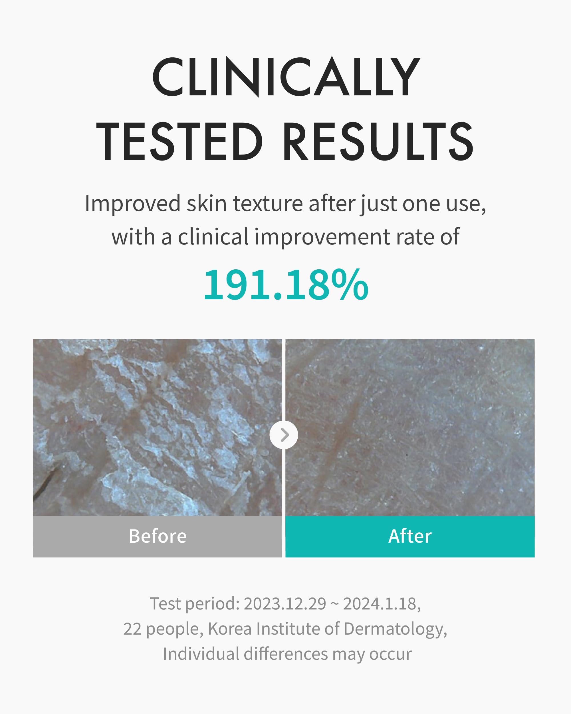 REJURAN Ceramides-rich formula close-up emphasizing barrier repair and long-lasting hydration.