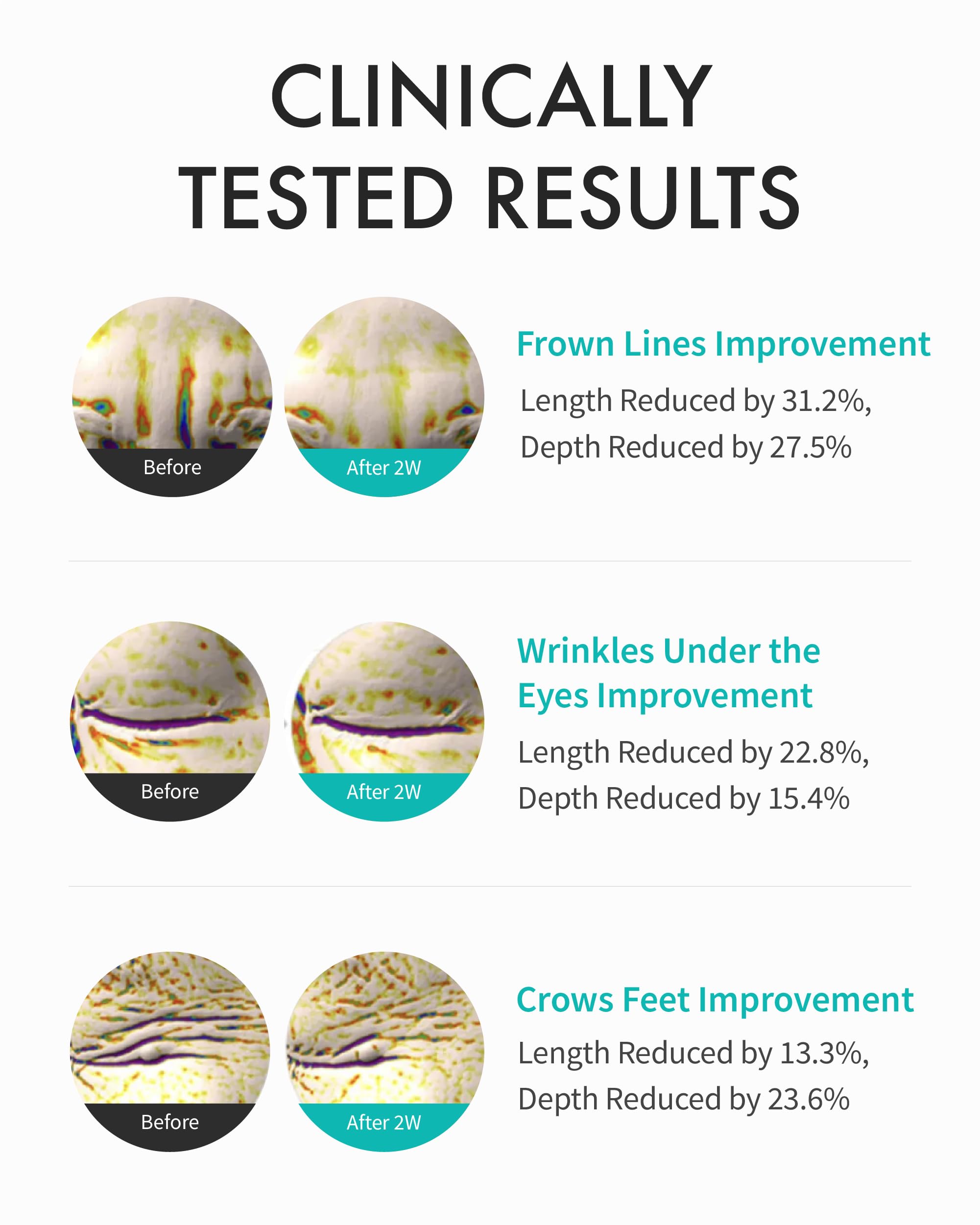 Rejuran eye cream peptide formula image; supports firm, resilient eye area.