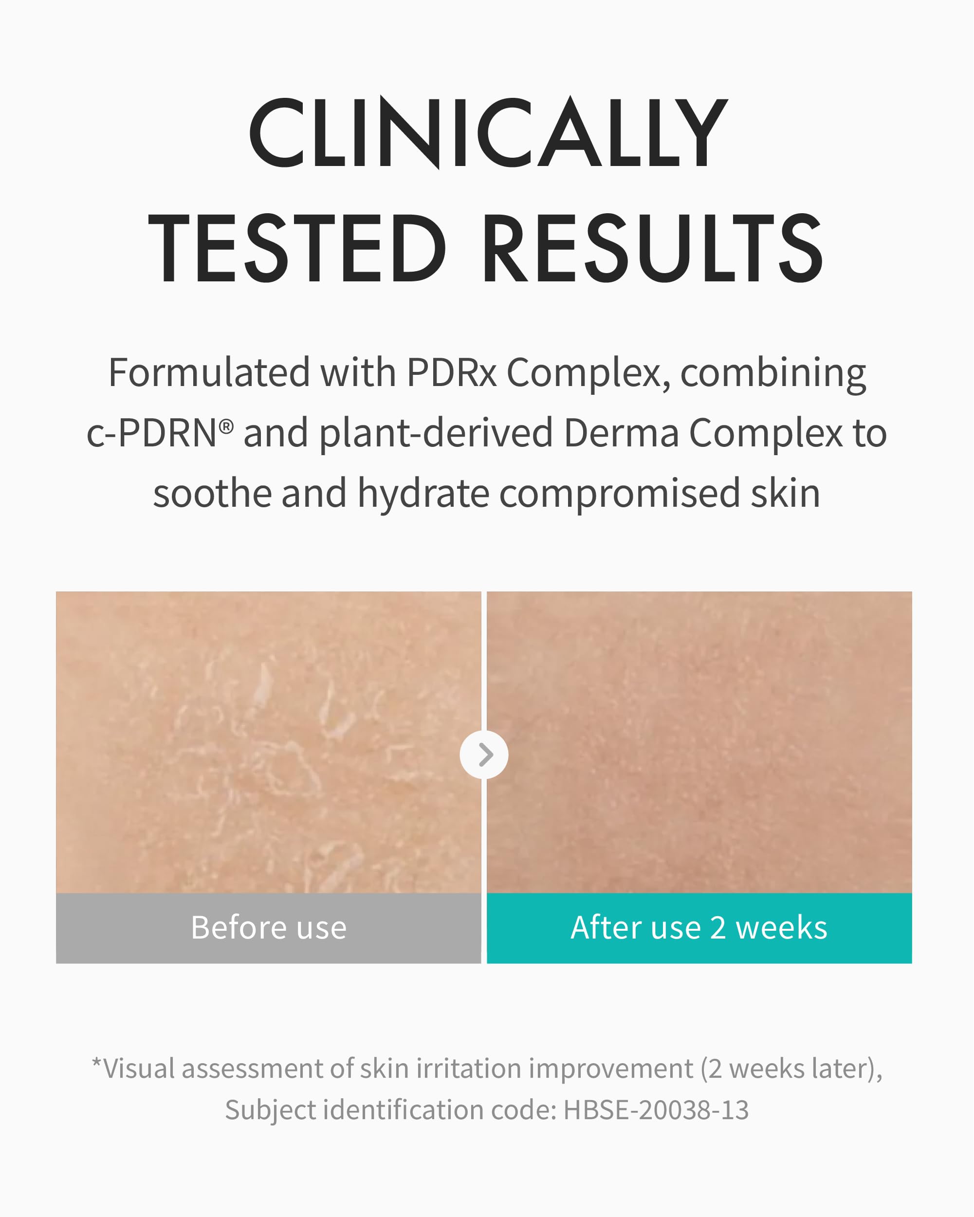 REJURAN Moisture Cream ceramides illustration communicates barrier supporting formula