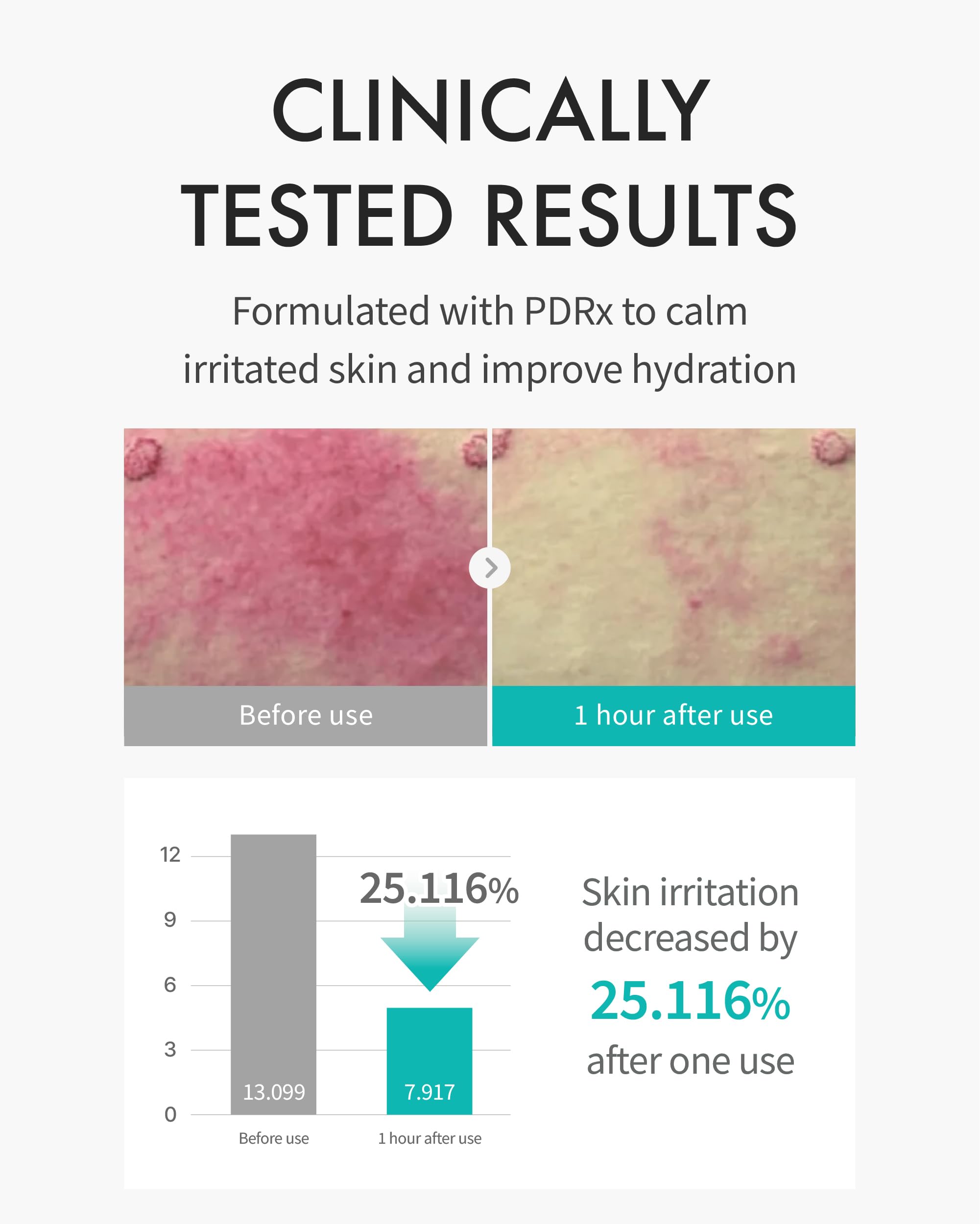REJURAN Moisture Treatment Mask applied on the face delivering instant hydration.