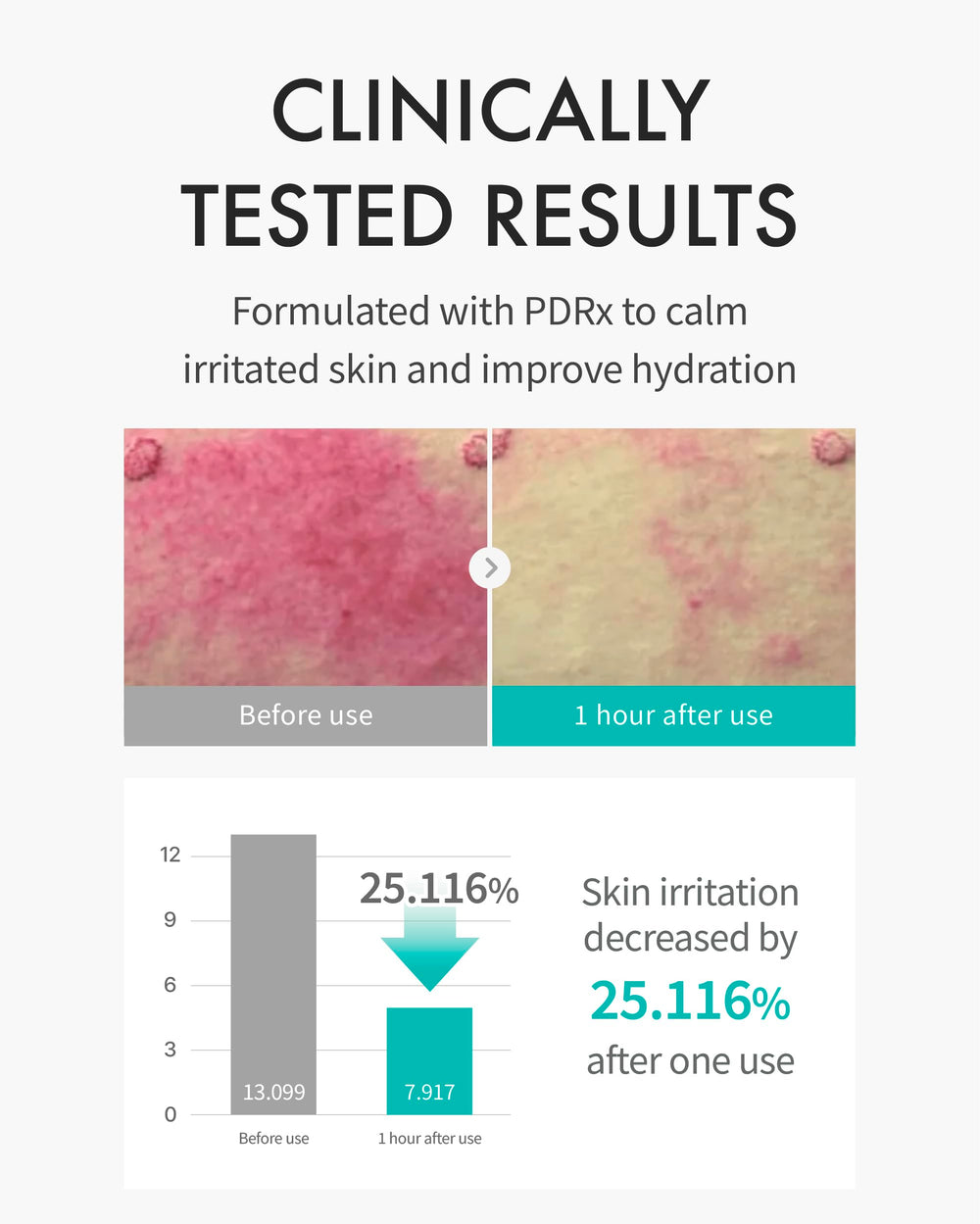 REJURAN Moisture Treatment Mask applied on the face delivering instant hydration.