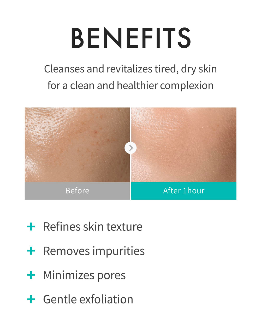 REJURAN Refining Foam Cleanser tightens pores and balances oil for clearer skin