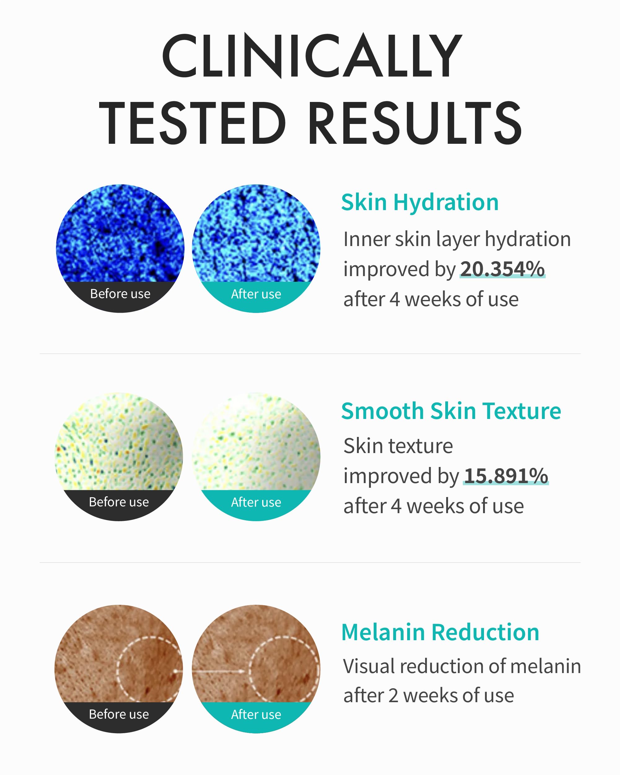 REJURAN Turnover Cream tube closeup highlighting sleek design for easy daily use.