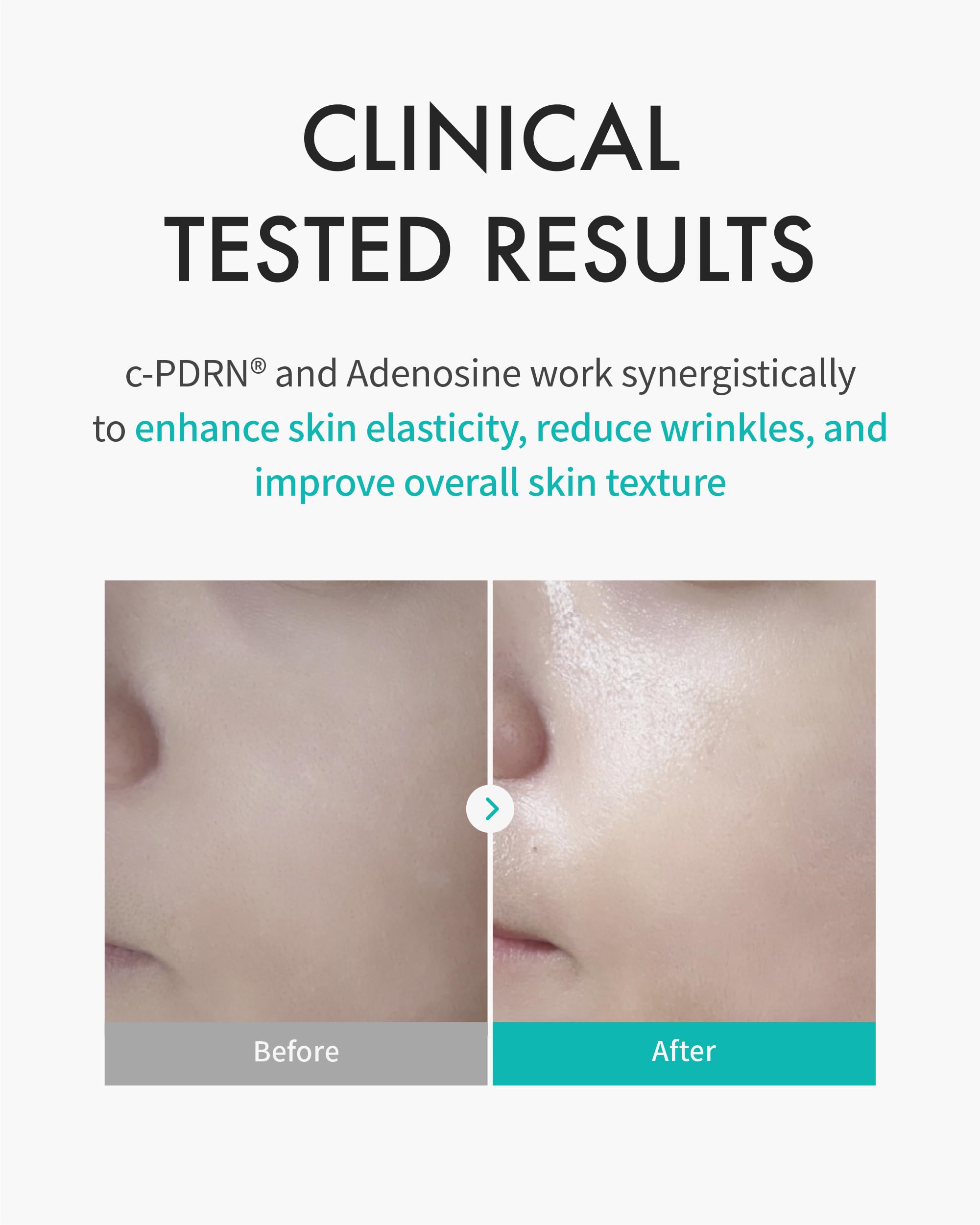 REJURAN Turnover Mask ultra-microfiber sheet closeup shows plush fabric and absorption benefits