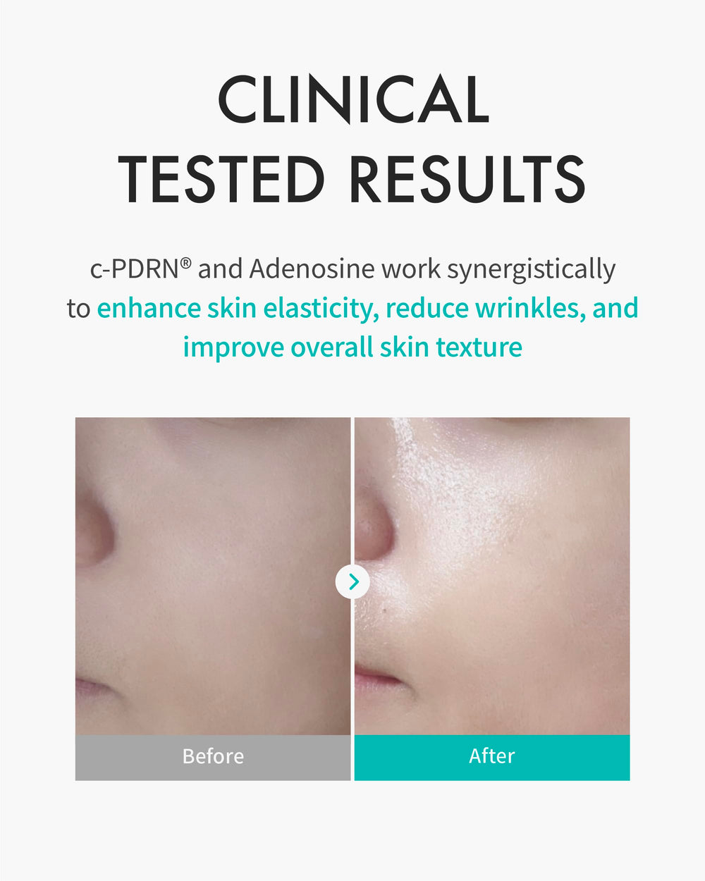 REJURAN Turnover Mask ultra-microfiber sheet closeup shows plush fabric and absorption benefits