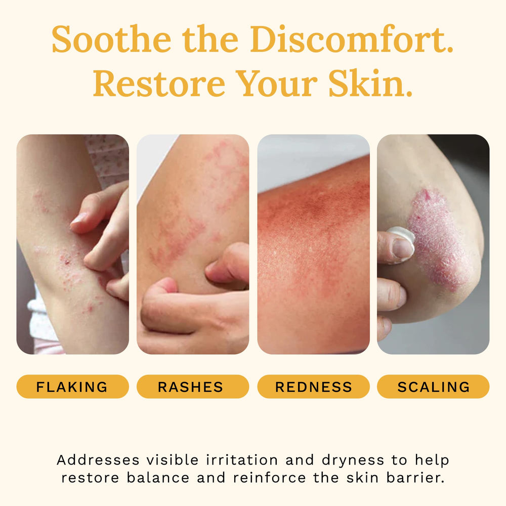 Rejuvaskin Skin Recovery Cream radiation-dermatitis use case visuals