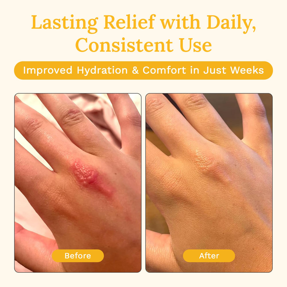 Rejuvaskin Skin Recovery Cream texture closeup shows non-greasy finish