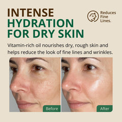 RejuveNaturals pumpkin seed oil moisturizes dry skin with vitamin-rich nourishment.