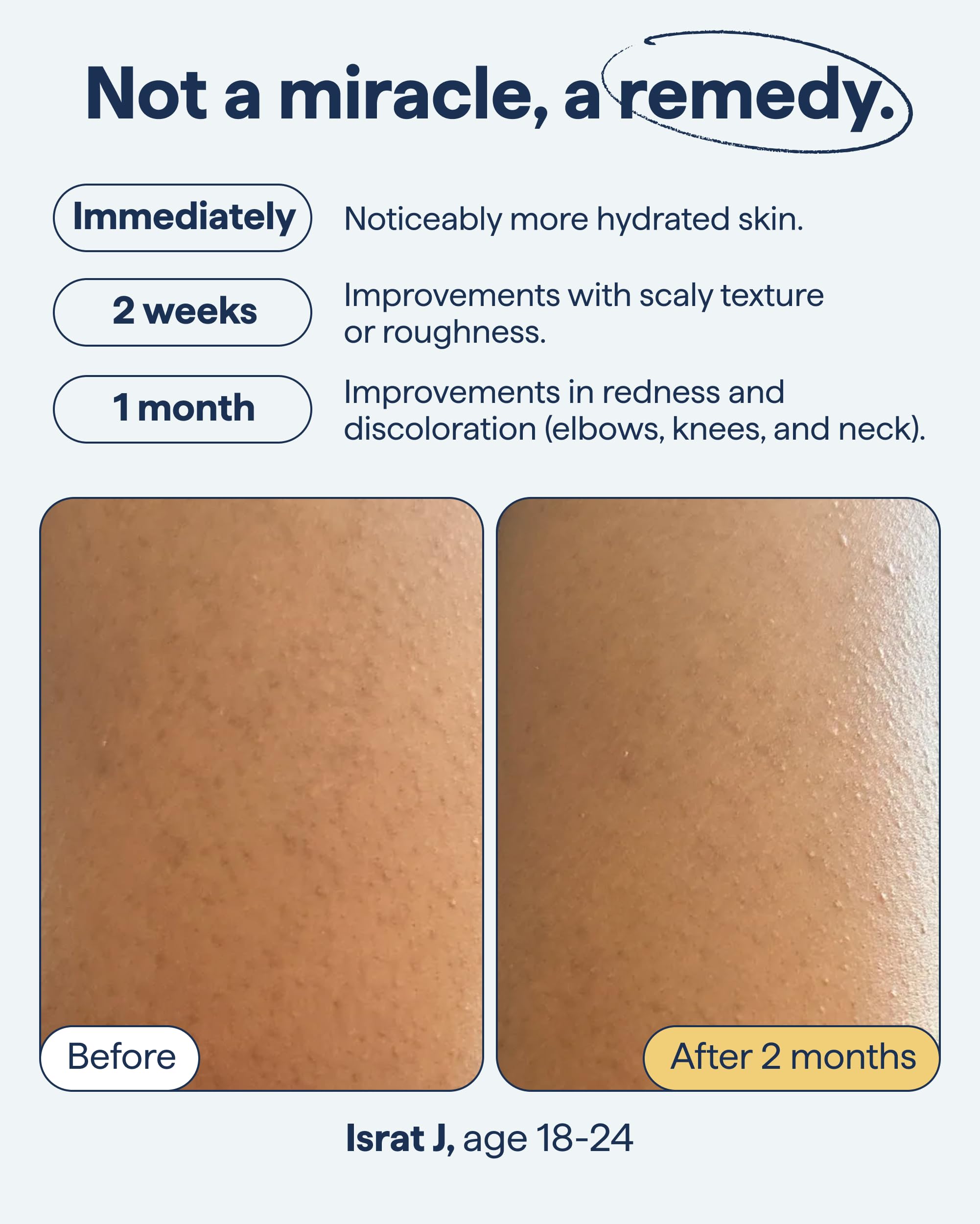 Remedy Science dermatologist-tested label signals dermatologist-created skincare.