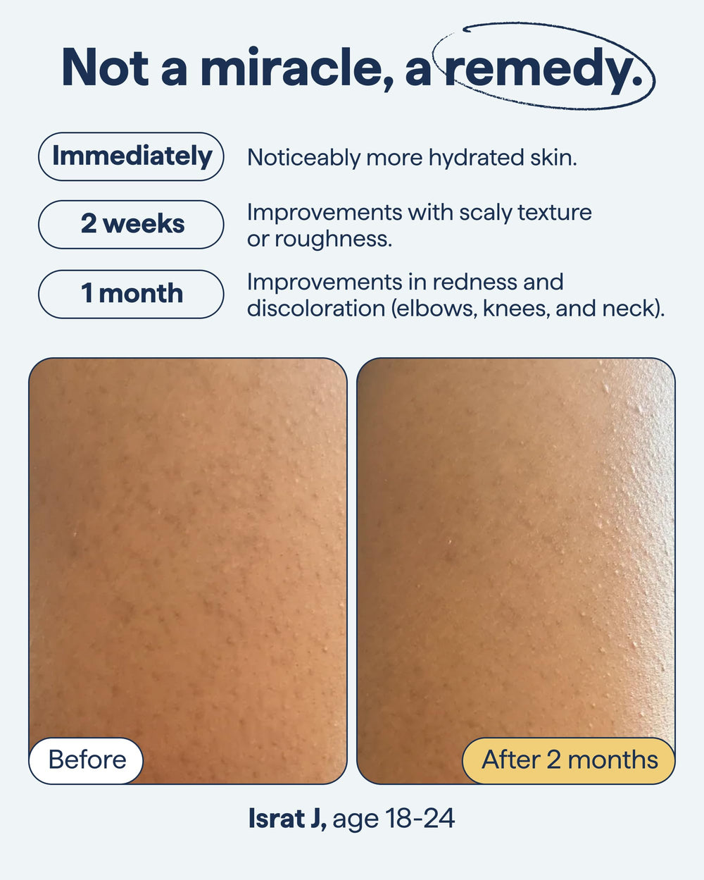 Remedy Science dermatologist-tested label signals dermatologist-created skincare.