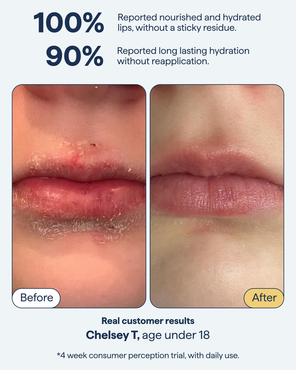 Remedy Science lip balm dimethicone barrier illustration for lasting seal.
