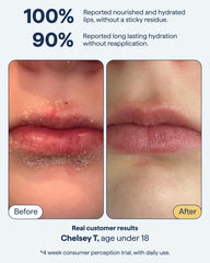 Remedy Science lip balm dimethicone barrier illustration for lasting seal.
