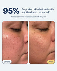 Remedy for Light Moisture ingredients include ceramide NP and niacinamide for balance
