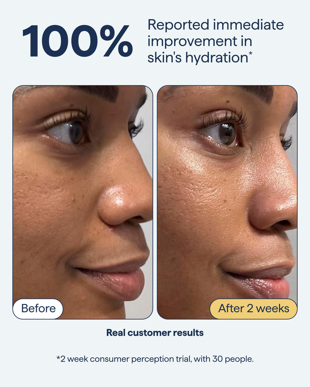 Remedy for Rich Moisture quadruple ceramide focus enhances barrier-friendly hydration.