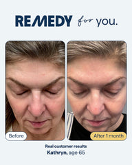 Remedy Science resveratrol-ferulic antioxidant complex protects collagen and supports skin resilience