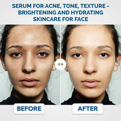 Renewa AgeDefy Niacinamide 5% Serum hyaluronic acid droplets illustrate deep hydration and plump skin feel.