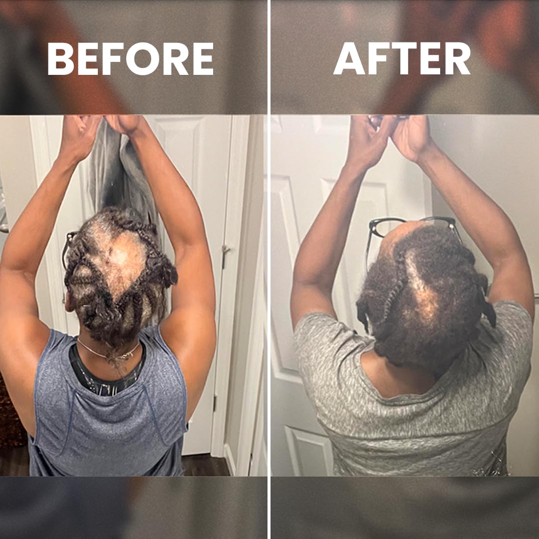 Rennora Beauty daily routine scene with serum for textured hair