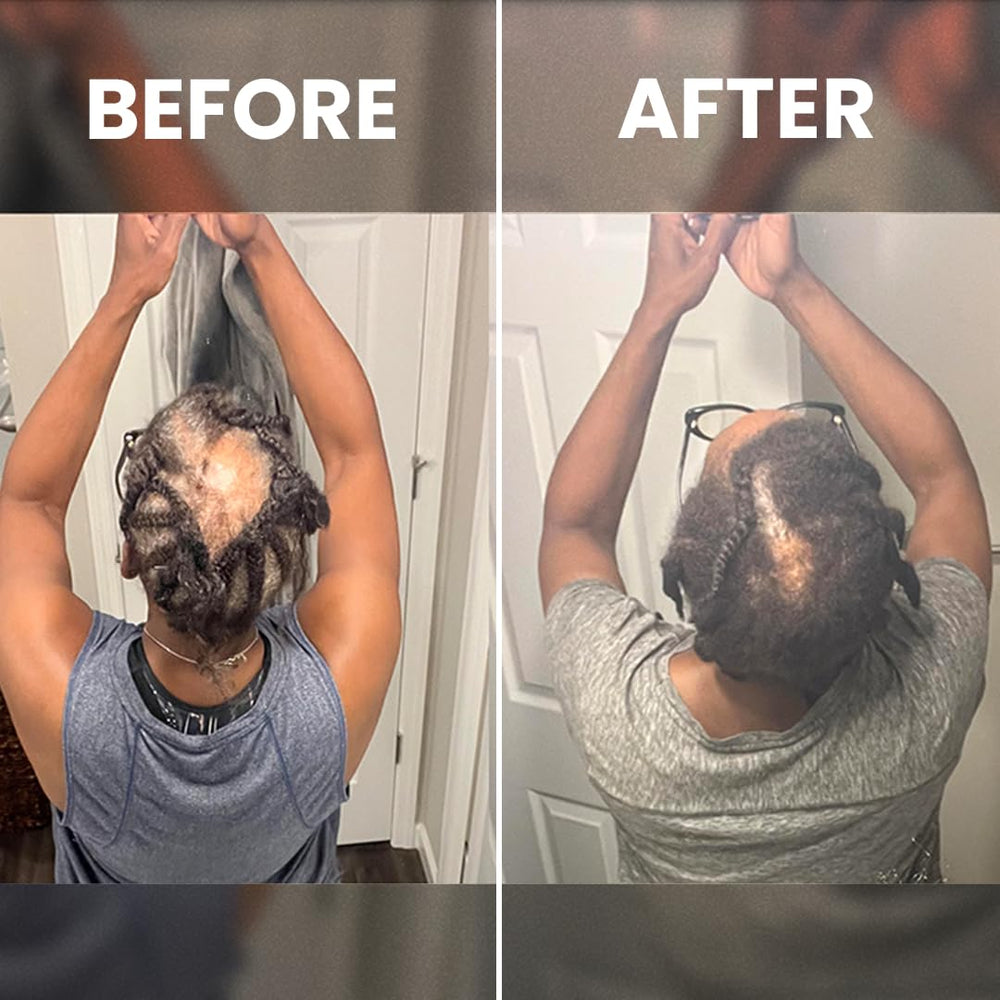 Rennora Beauty daily routine scene with serum for textured hair