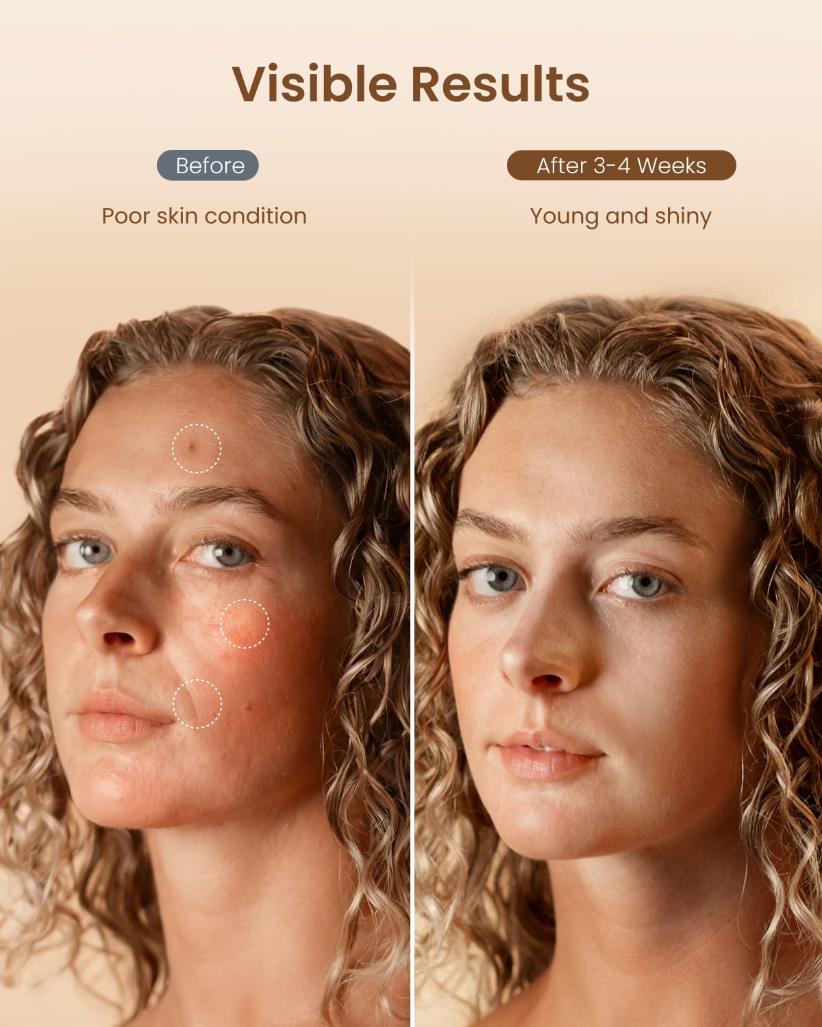 RENPHO ultra-light silicone skin-friendly material for comfortable wear