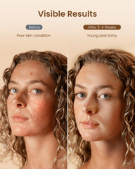 RENPHO ultra-light silicone skin-friendly material for comfortable wear
