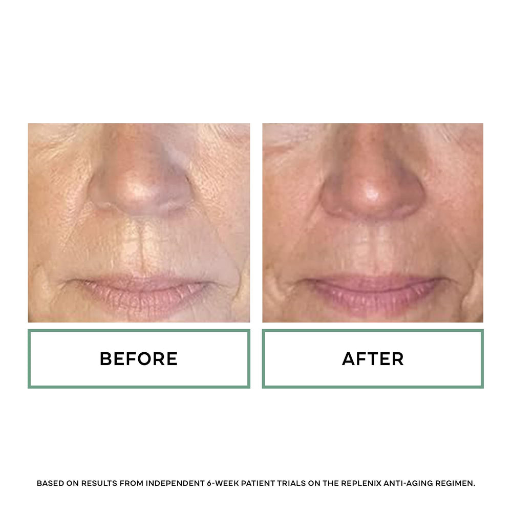 Replenix Age Restore supports nightly elasticity and even tone