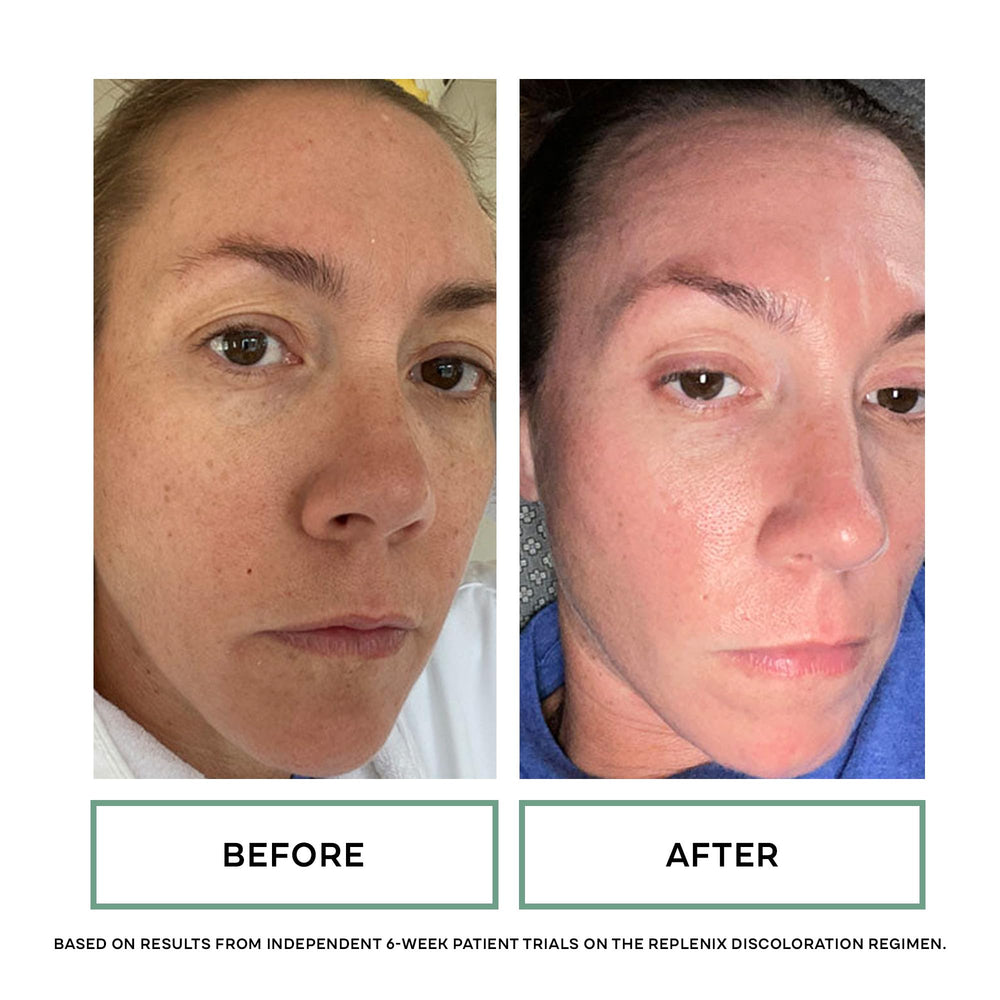 Replenix Glycolic Acid 10% pads anti-irritation design supports gentle resurfacing.