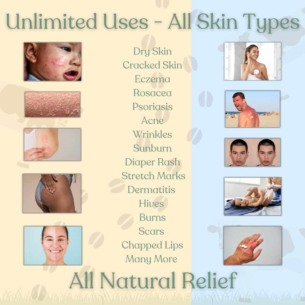 Reroot Organics Naked Tallow Balm may support eczema psoriasis-prone areas with gentle care