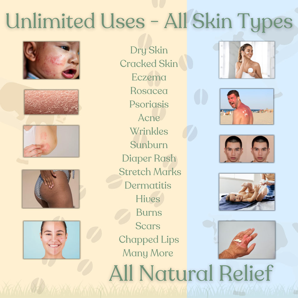 Reroot Organics Naked Tallow Balm for eczema-psoriasis areas offering soothing nourishment